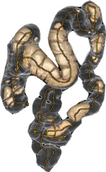 大腸3D画像